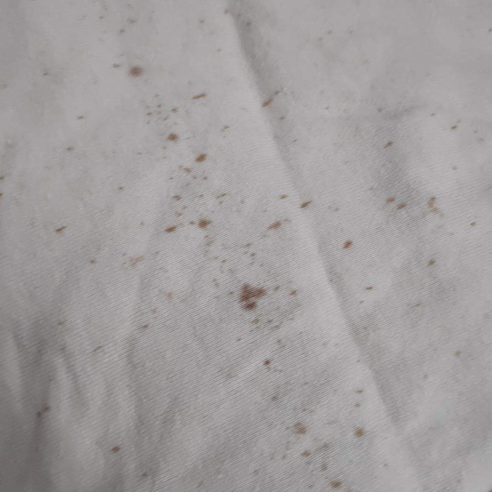 Types of Stains in Cloth Diapers – How to Manage and Prevent